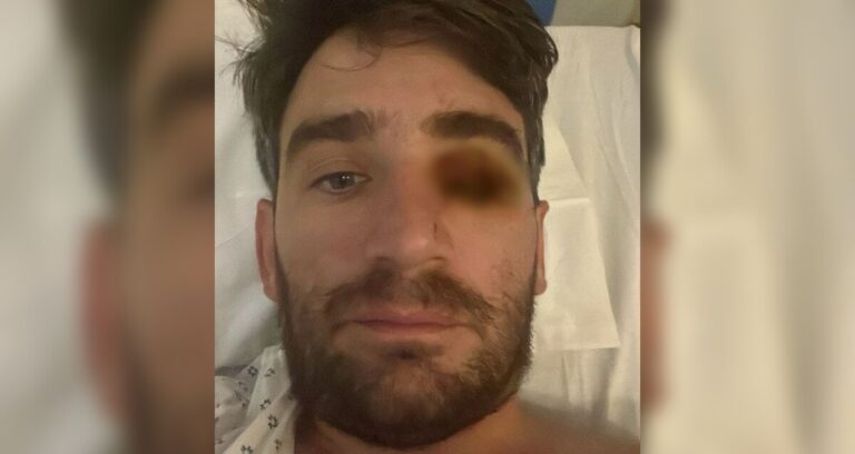 Año Nuevo Trágico: Hombre Pierde el Ojo por Explosión Pirotécnica en Lubbock